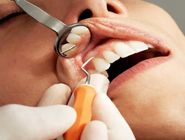 شناسایی دندانپزشکان فاقد مجوز با گزارش مردمی
