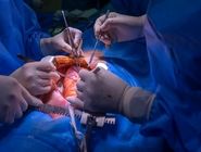 دبیر علمی «نهمین  کنگره بین المللی نارسایی قلب ایران»: تنها 20 درصد متقاضیان در لیست انتظار،موفق به دریافت قلب پیوندی می شوند