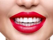 مقایسه کامپوزیت زنیت و توکویاما + قیمت و رنگبندی