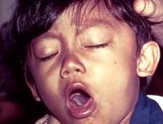 هشدار جدی درمورد بازگشت یک بیماری