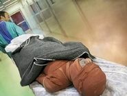 آمارن نگران‌کننده از میزان سوختگی‌ها: ایرانی‌ها ۸ برابر دنیا دچار سوختگی می‌شوند